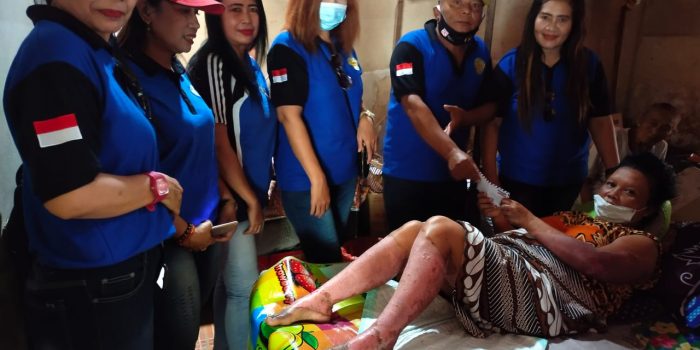 Segoro Biru Santuni Bu Damini Korban Ledakan LPG